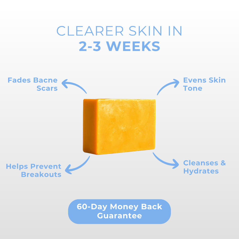 Back Acne Soap Bar