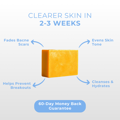 Back Acne Soap Bar