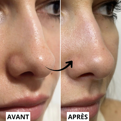 Korean White Rice Peel Serum