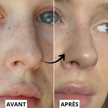 Korean White Rice Peel Serum