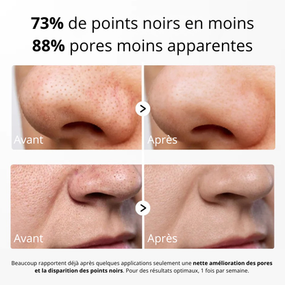 Korean White Rice Peel Serum