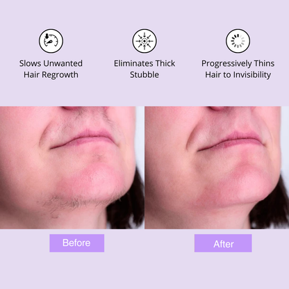 Anti-Hair Regrowth Serum